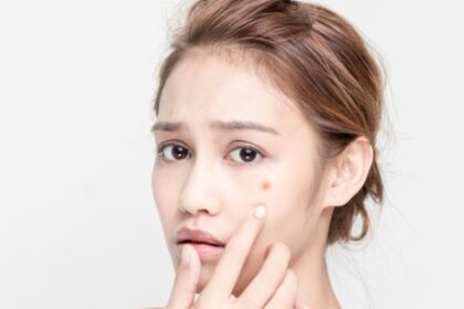 मुहांसों को दूर भगाने के लिए चेहरे पर लगाएं ये 5 कोरियाई फेस मास्क, दिखेंगी खूबसूरती