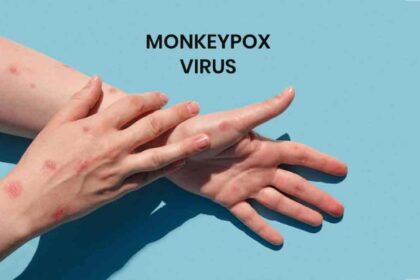 मंकीपॉक्स का खतरा
