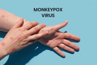 दुनियाभर में एमपॉक्स वायरस के मामलों में तेजी से भारत समेत कई देशों की बढ़ी चिंता