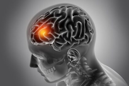 क्या दिमाग के अंदर भी हो सकता है कैंसर? जानें क्या होते हैं इसके लक्षण